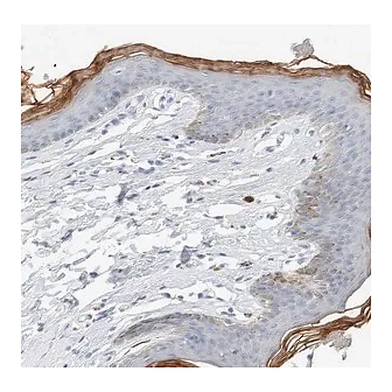 Merck Anti-ALOX12B antibody produced in rabbit