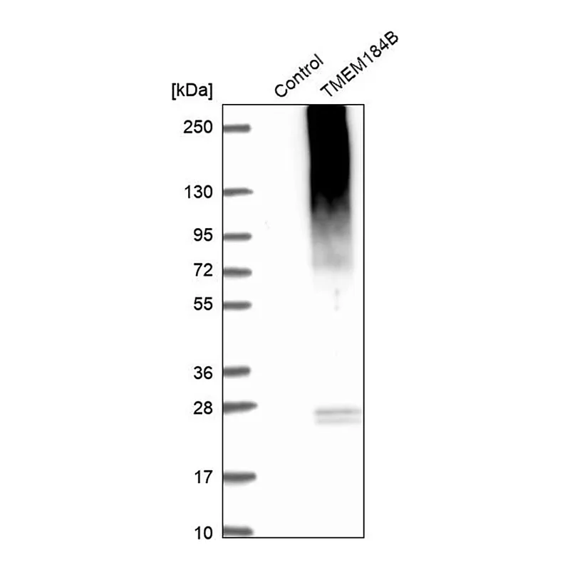 Merck Anti-TMEM184B antibody produced in rabbit