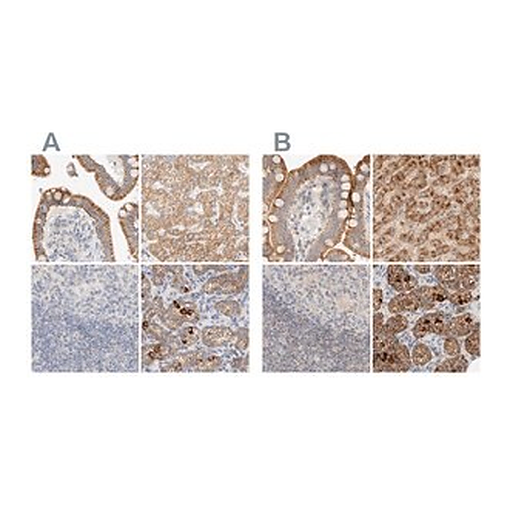 Merck Anti-HDHD3 antibody produced in rabbit