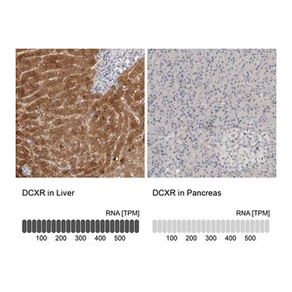 Merck Anti-DCXR antibody produced in rabbit