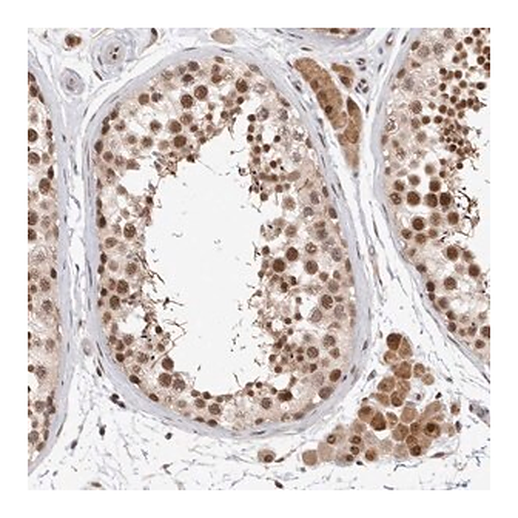 Merck Anti-HESX1 antibody produced in rabbit