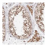 Merck Anti-HESX1 antibody produced in rabbit