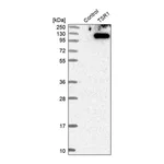 Merck Anti-TSR1 antibody produced in rabbit