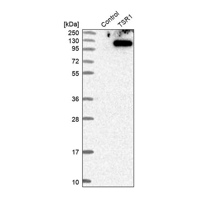 Merck Anti-TSR1 antibody produced in rabbit
