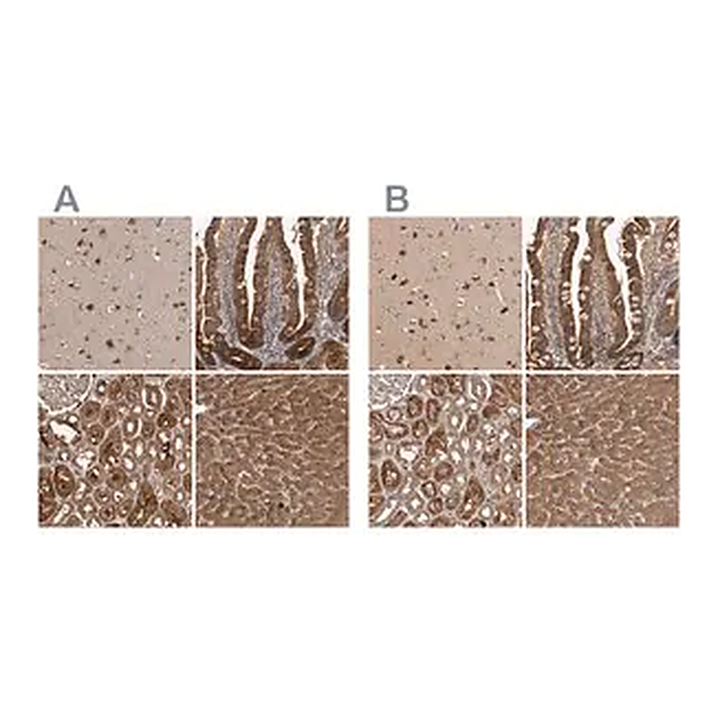 Merck Anti-TRMT61B antibody produced in rabbit