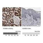 Merck Anti-ACADM antibody produced in rabbit
