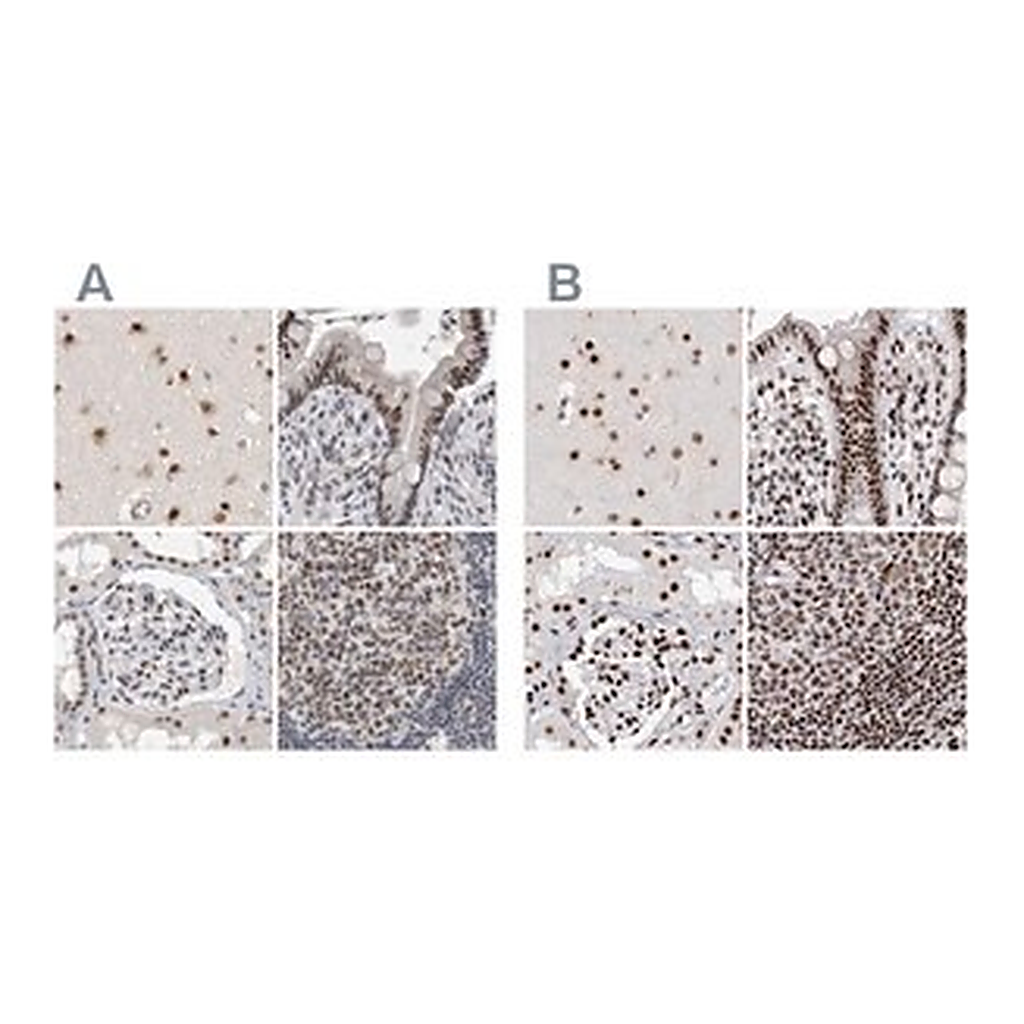Merck Anti-RBM6 antibody produced in rabbit