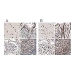 Merck Anti-RBM6 antibody produced in rabbit