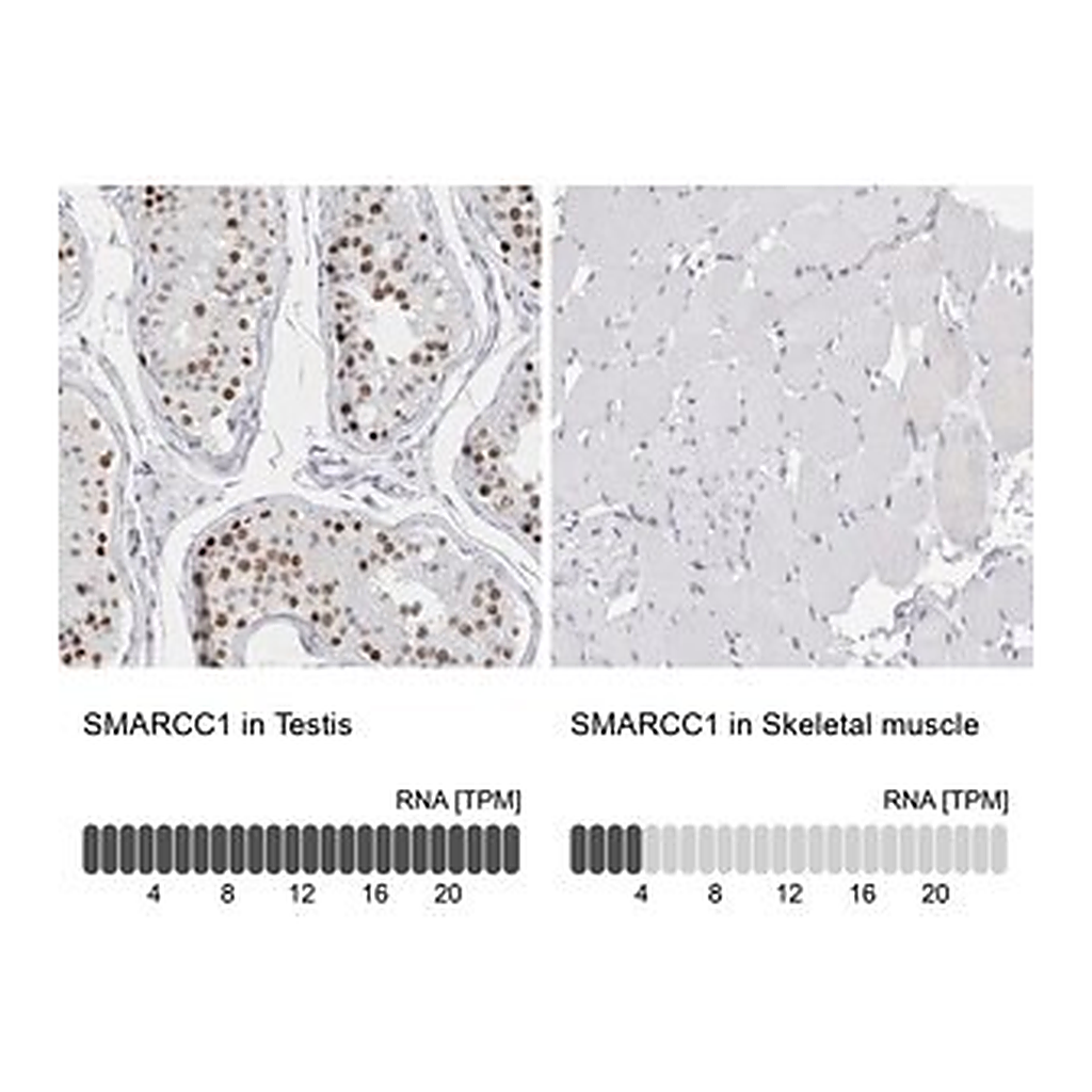 Merck Anti-SMARCC1 antibody produced in rabbit