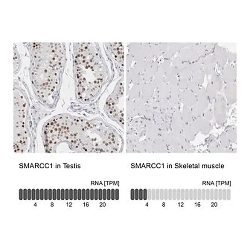 Merck Anti-SMARCC1 antibody produced in rabbit