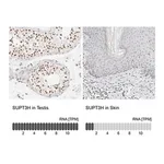 Merck Anti-SUPT3H antibody produced in rabbit