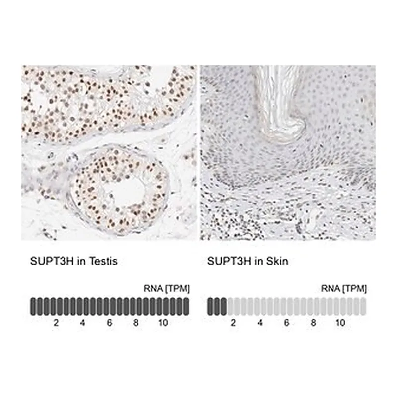 Merck Anti-SUPT3H antibody produced in rabbit