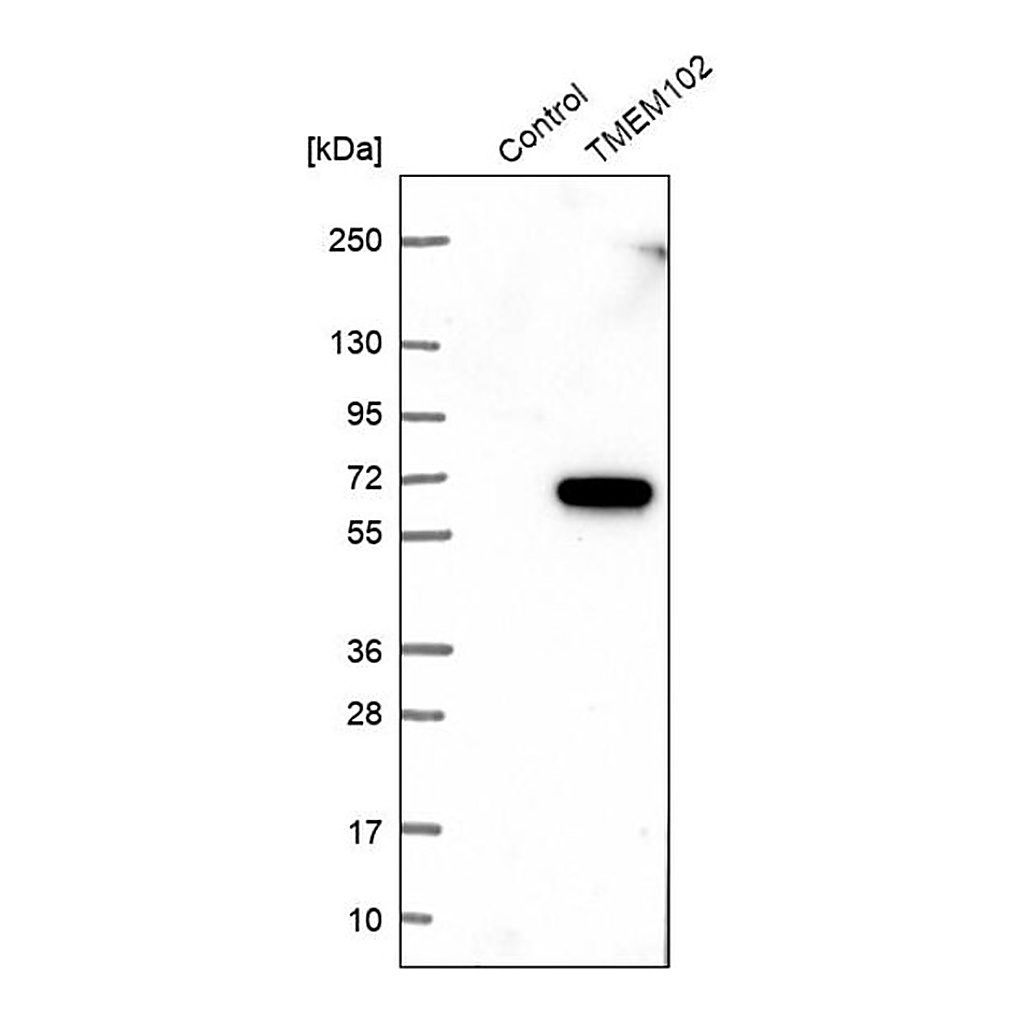 Merck Anti-TMEM102 antibody produced in rabbit