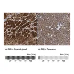 Merck Anti-ALAD antibody produced in rabbit