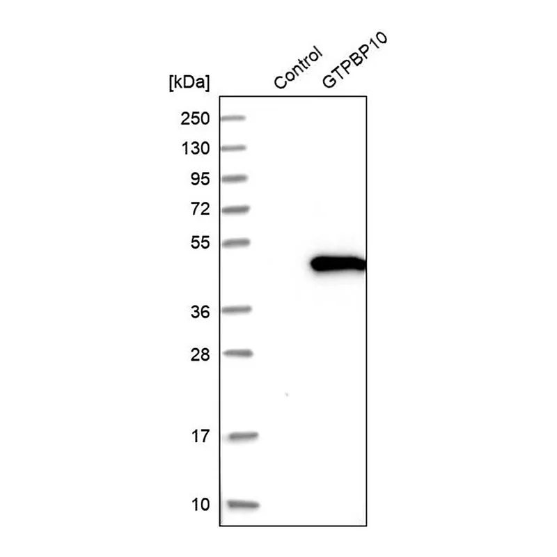 Merck Anti-GTPBP10 antibody produced in rabbit
