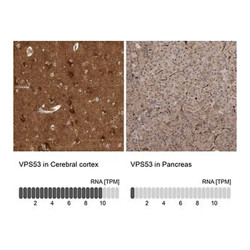 Merck Anti-VPS53 antibody produced in rabbit