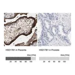 Merck Anti-HSD17B1 antibody produced in rabbit