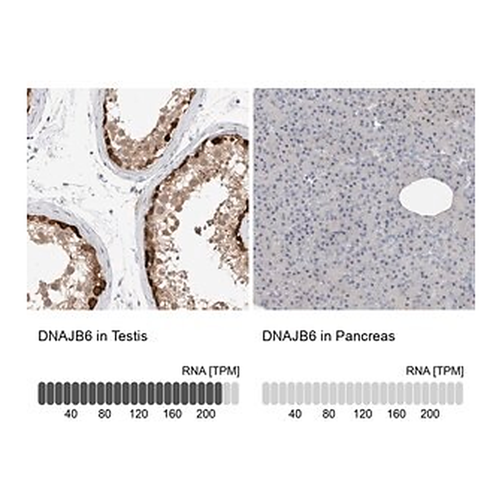 Merck Anti-DNAJB6 antibody produced in rabbit