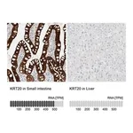Merck Anti-KRT20 antibody produced in rabbit