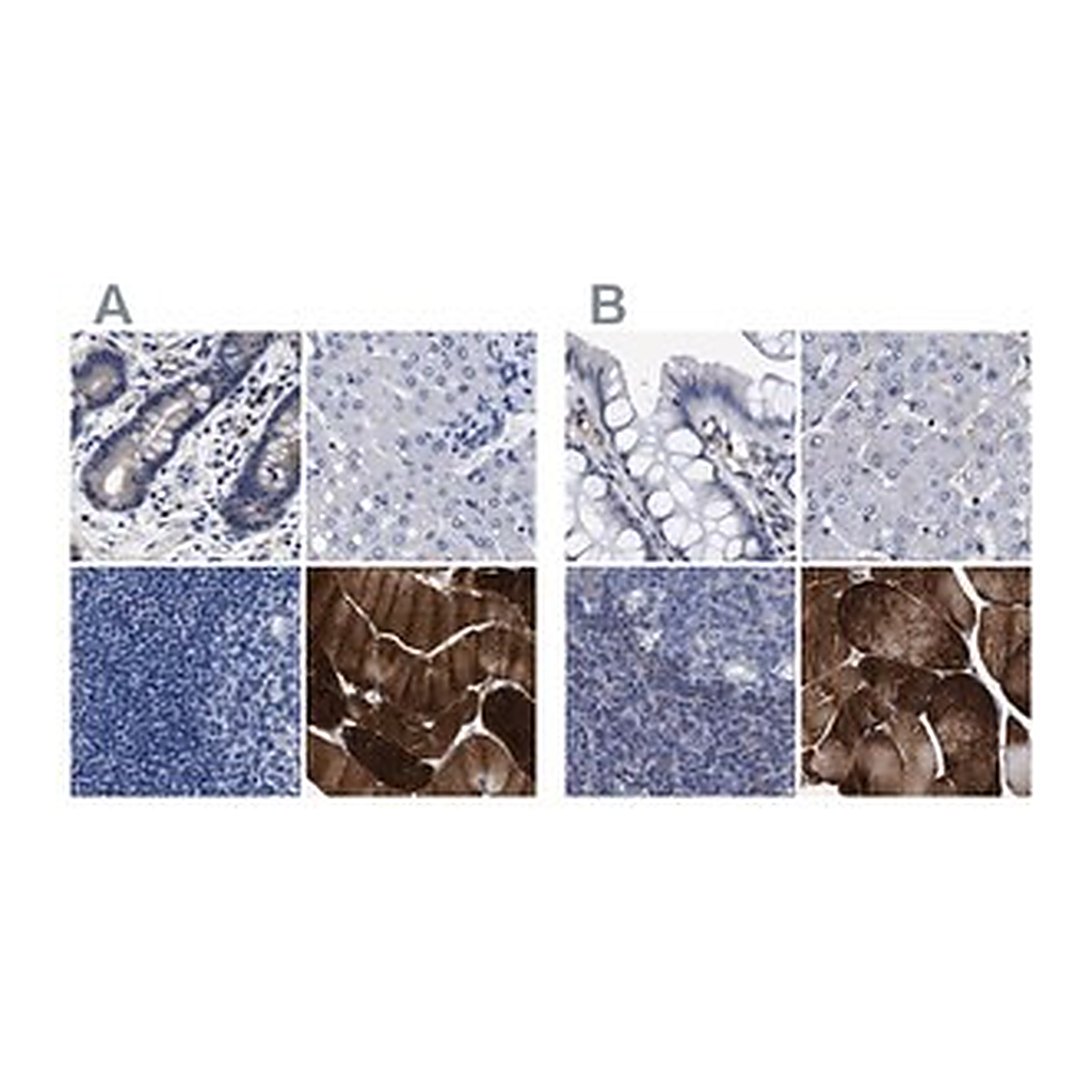 Merck Anti-KLHL41 antibody produced in rabbit