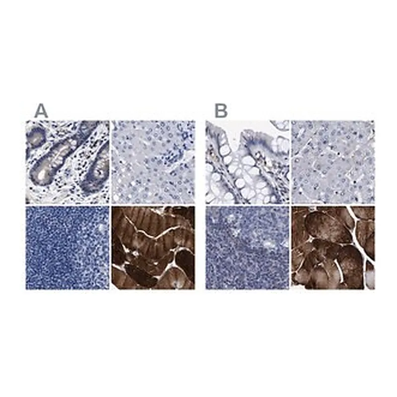 Merck Anti-KLHL41 antibody produced in rabbit