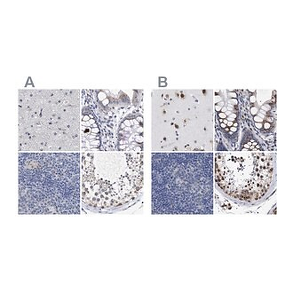 Merck Anti-GOLGA2 antibody produced in rabbit
