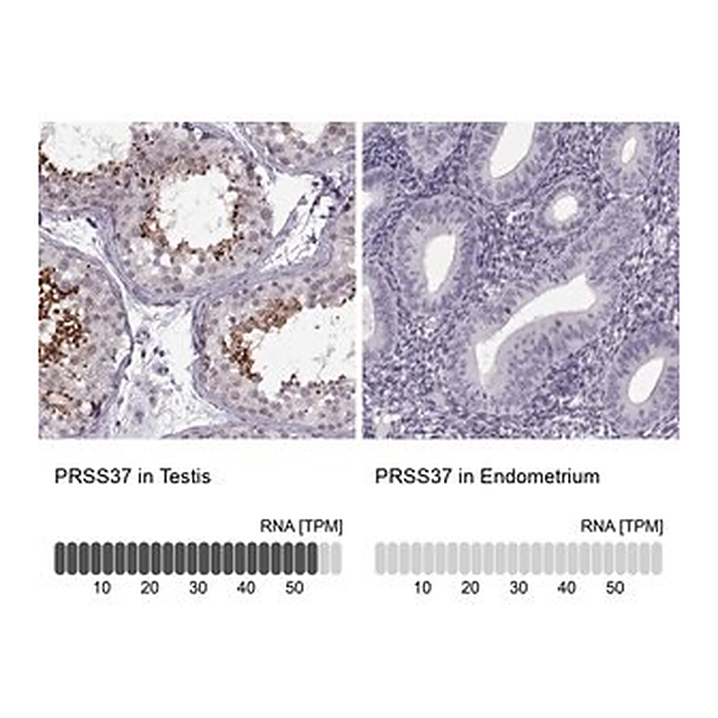 Merck Anti-PRSS37 antibody produced in rabbit