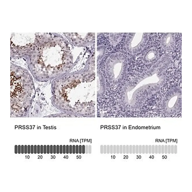 Merck Anti-PRSS37 antibody produced in rabbit