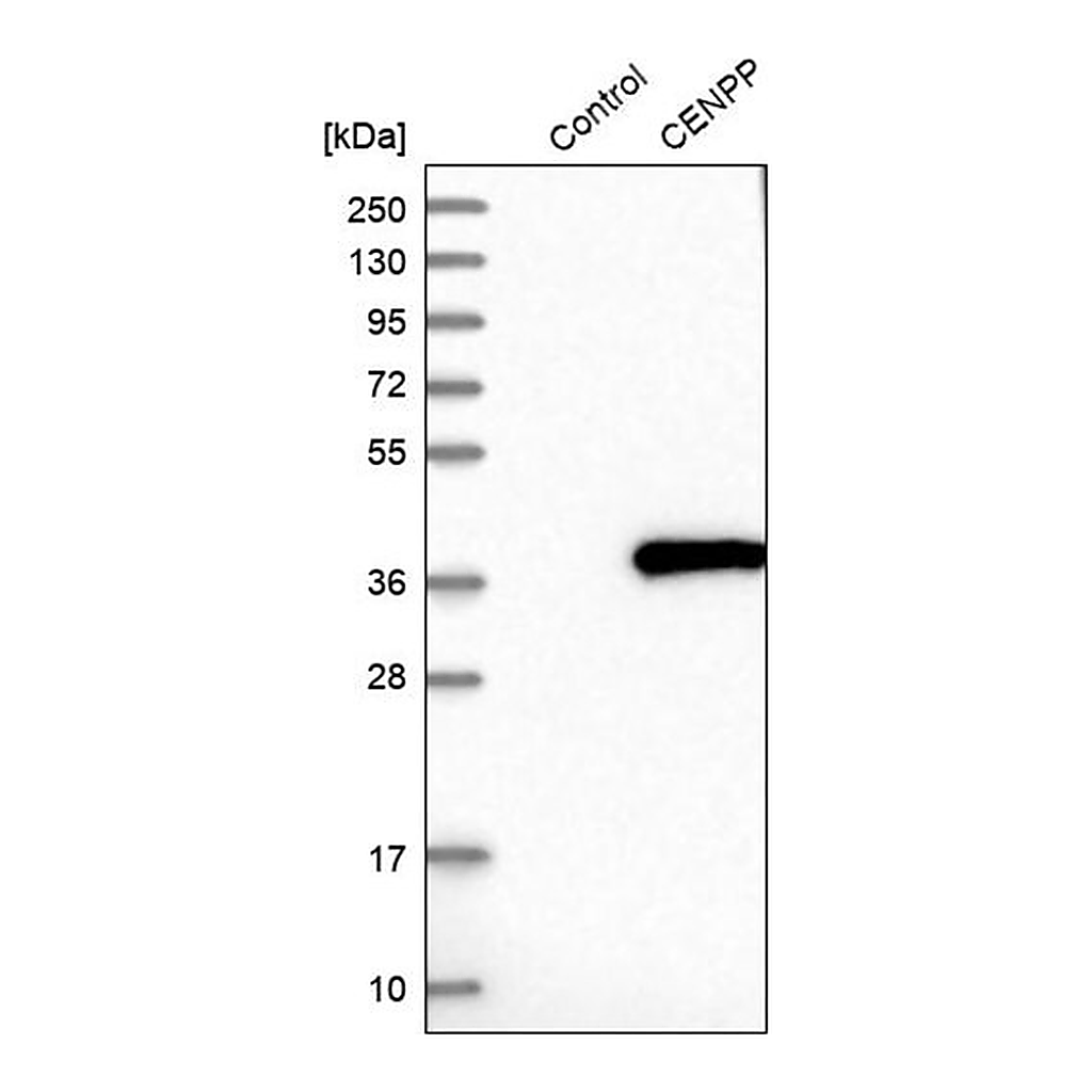 Merck Anti-CENPP antibody produced in rabbit