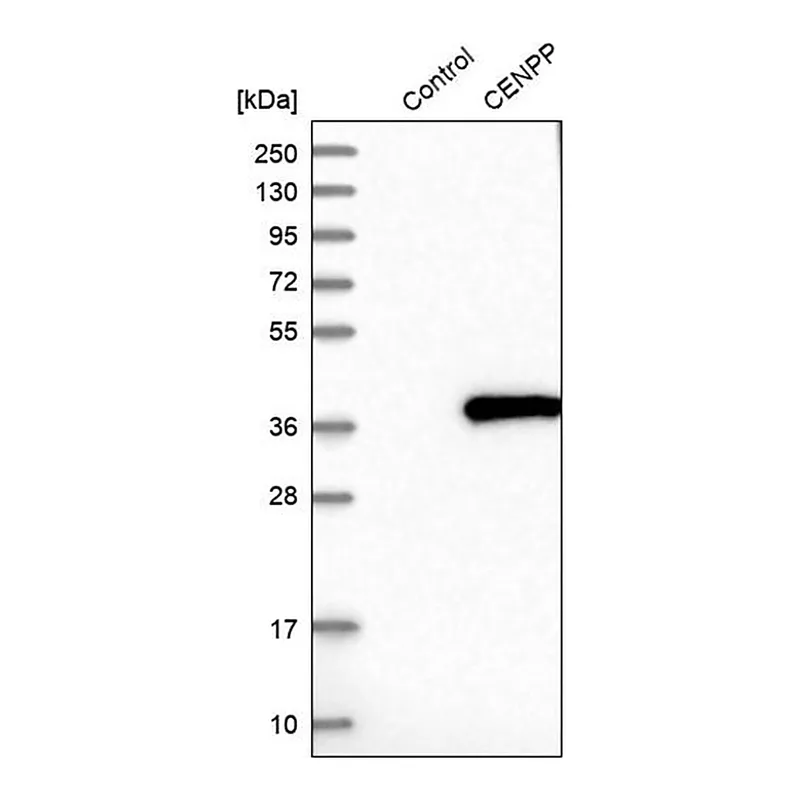 Merck Anti-CENPP antibody produced in rabbit