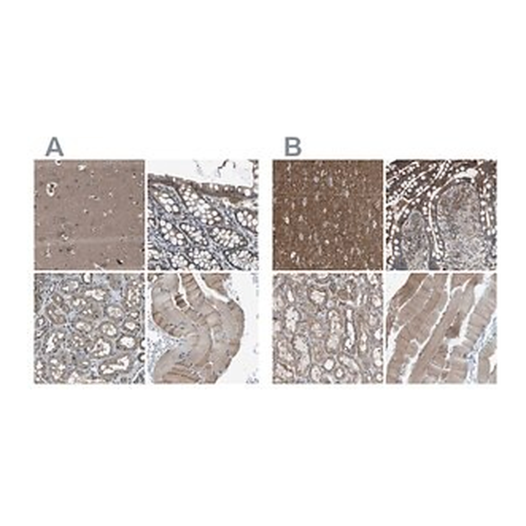 Merck Anti-MYO18A antibody produced in rabbit