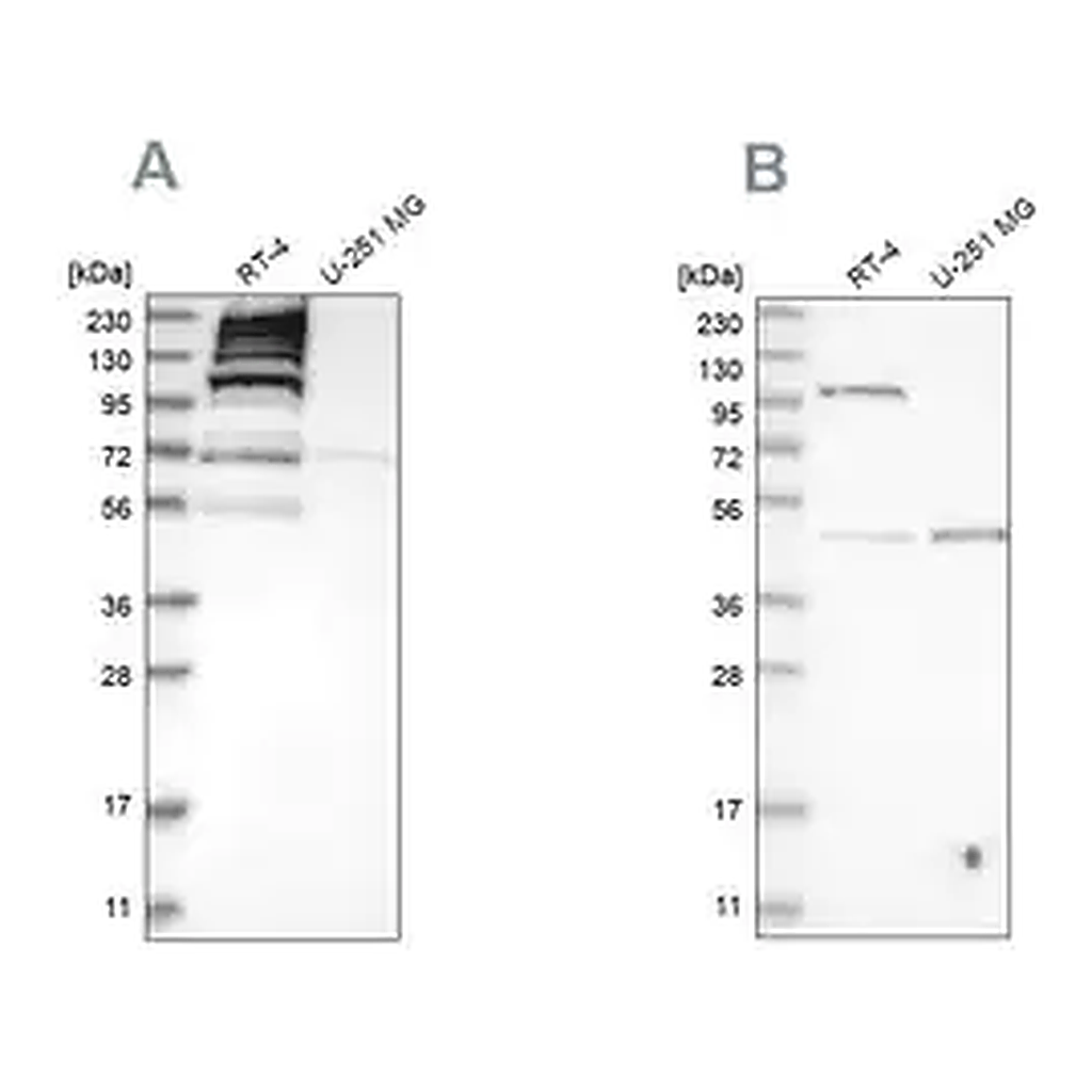 Merck Anti-C1orf112 antibody produced in rabbit