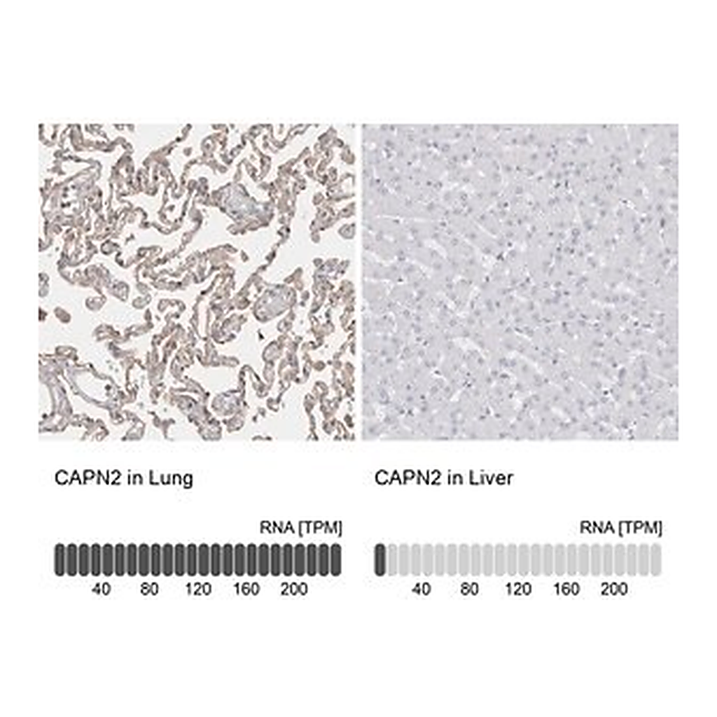 Merck Anti-CAPN2 antibody produced in rabbit