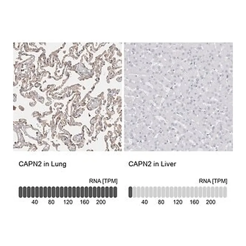 Merck Anti-CAPN2 antibody produced in rabbit