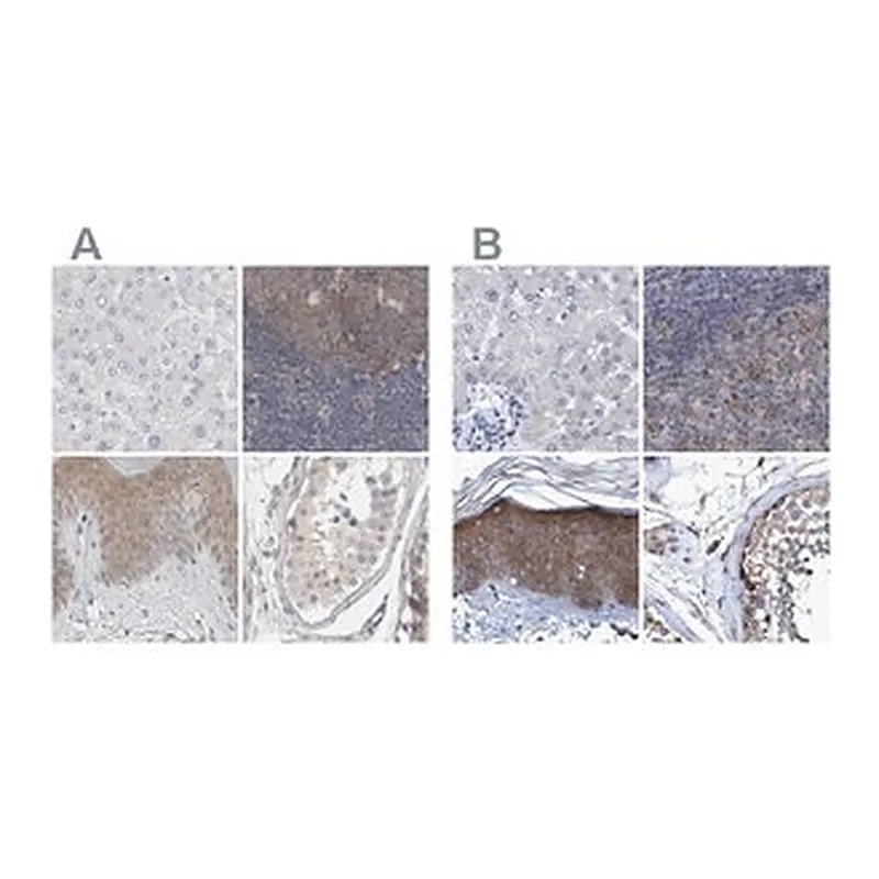 Merck Anti-BICD2 antibody produced in rabbit