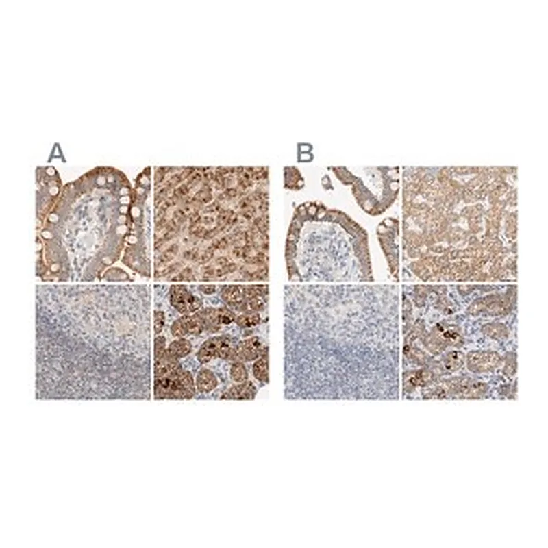 Merck Anti-HDHD3 antibody produced in rabbit