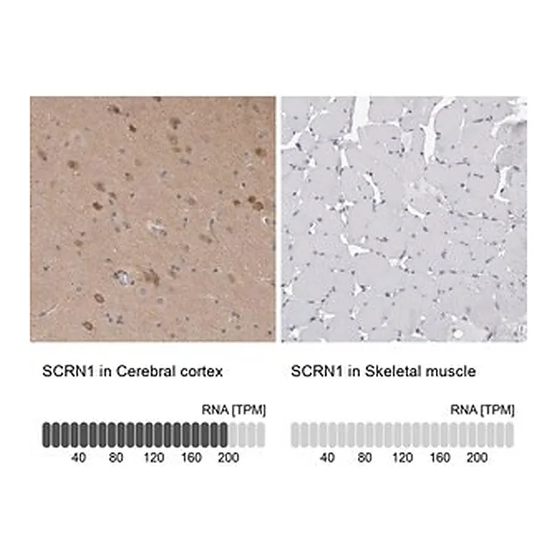 Merck Anti-SCRN1 antibody produced in rabbit
