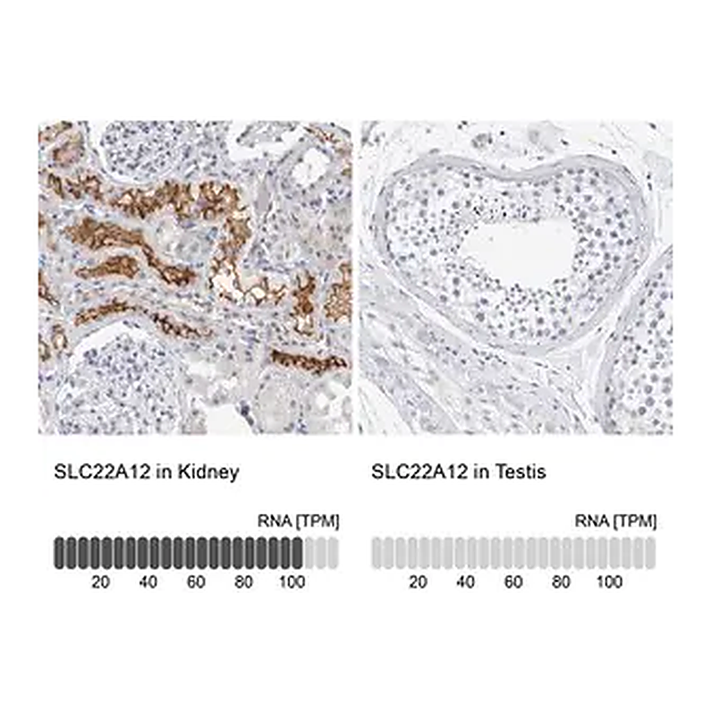 Merck Anti-SLC22A12 antibody produced in rabbit
