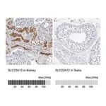 Merck Anti-SLC22A12 antibody produced in rabbit