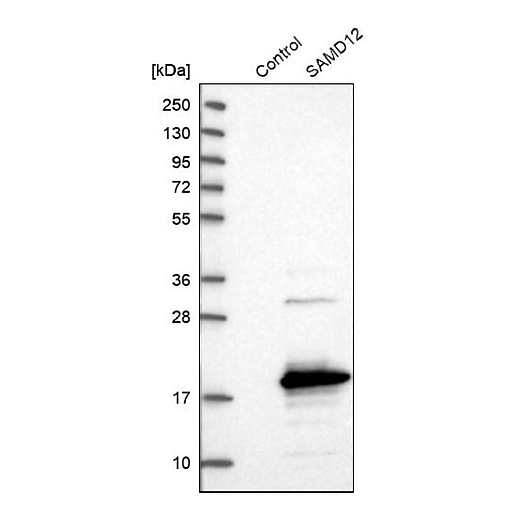 Merck Anti-SAMD12 antibody produced in rabbit