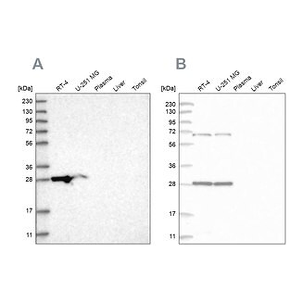 Merck Anti-MRPL10 antibody produced in rabbit
