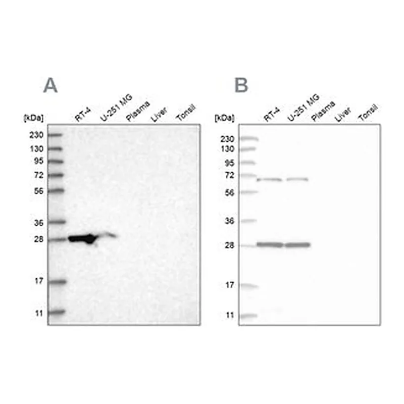 Merck Anti-MRPL10 antibody produced in rabbit