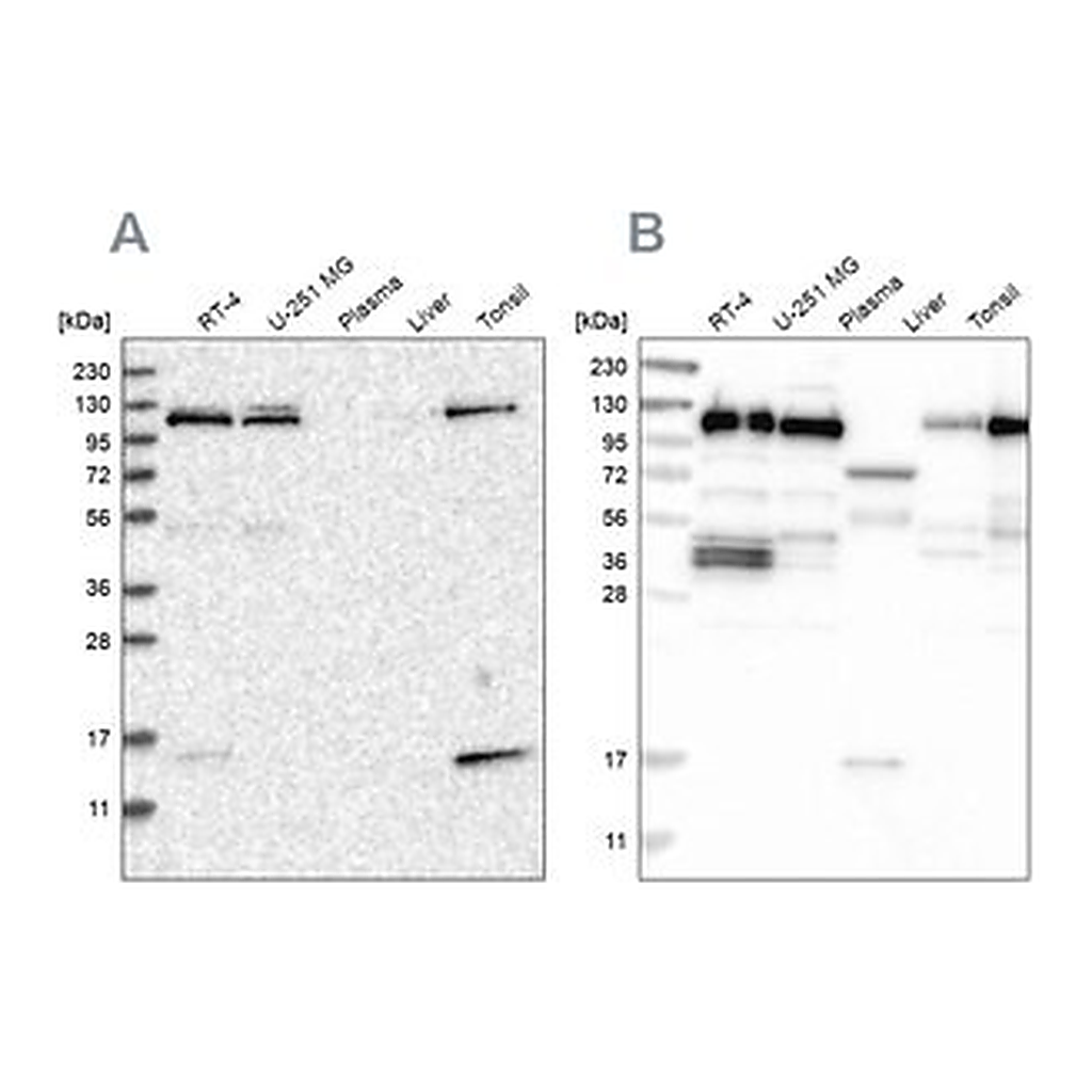 Merck Anti-RABEP1 antibody produced in rabbit