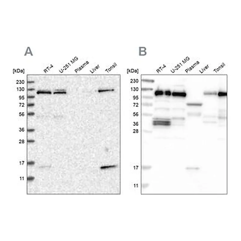 Merck Anti-RABEP1 antibody produced in rabbit