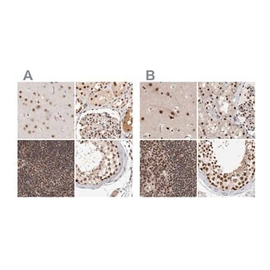 Merck Anti-ZNF830 antibody produced in rabbit