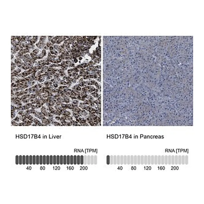 Merck Anti-HSD17B4 antibody produced in rabbit