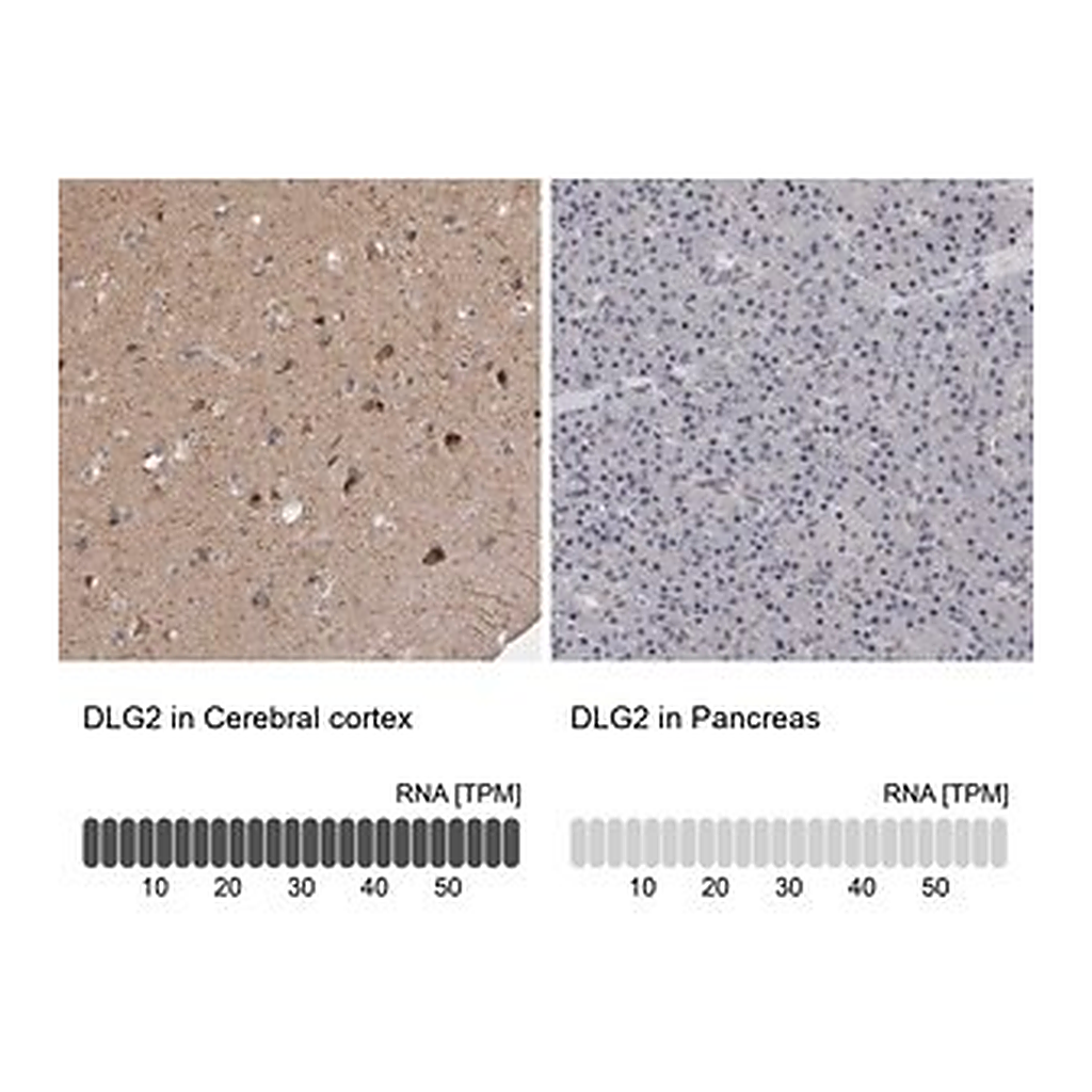Merck Anti-DLG2 antibody produced in rabbit