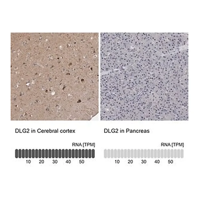 Merck Anti-DLG2 antibody produced in rabbit