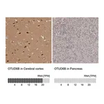 Merck Anti-OTUD6B antibody produced in rabbit