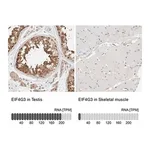 Merck Anti-EIF4G3 antibody produced in rabbit
